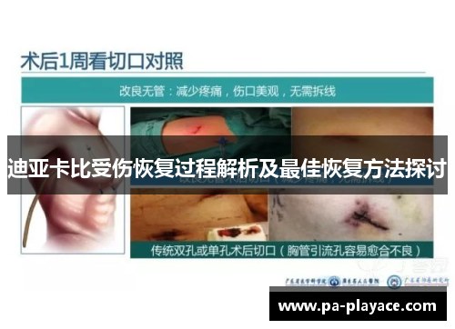 迪亚卡比受伤恢复过程解析及最佳恢复方法探讨